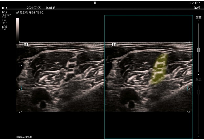 Diagnostic Ultrasound Machines