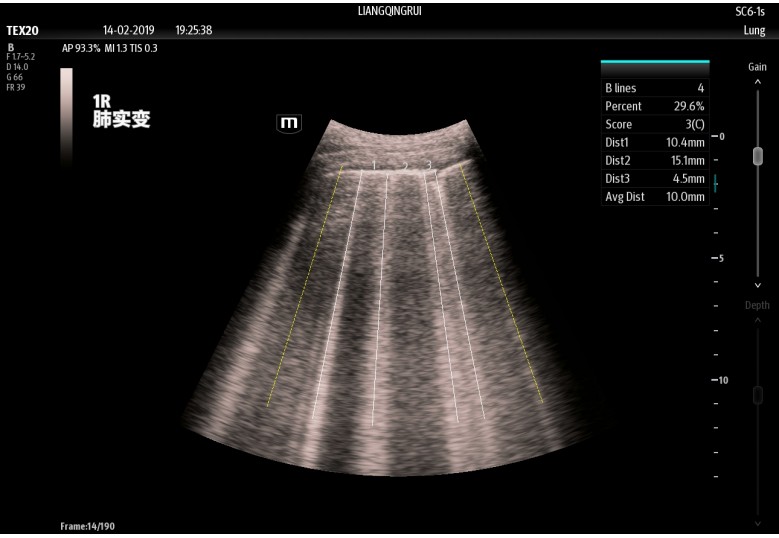 Diagnostic Ultrasound Machines