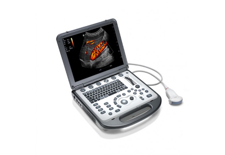 M6 Ultrasound System (Point-of-Care)