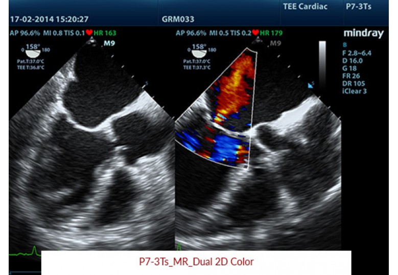 Diagnostic Ultrasound Machines