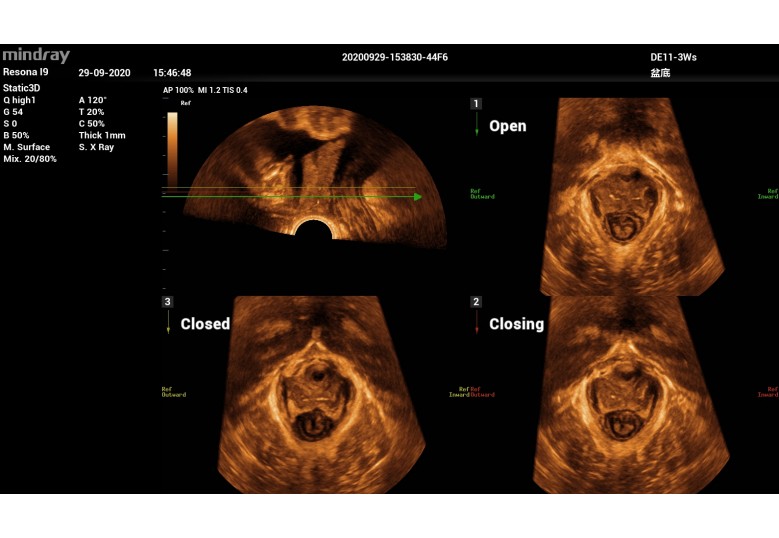 Diagnostic Ultrasound Machines